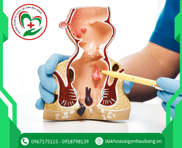 Bệnh lý ung bướu cần can thiệp ngoại khoa