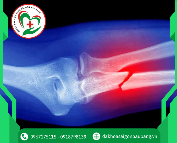 Chấn thương và Cấp cứu Ngoại Khoa
