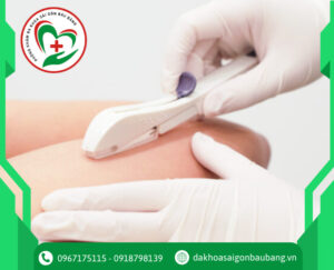 Cấy Que Tránh Thai: Hiệu Quả, An Toàn Và Không Đau?