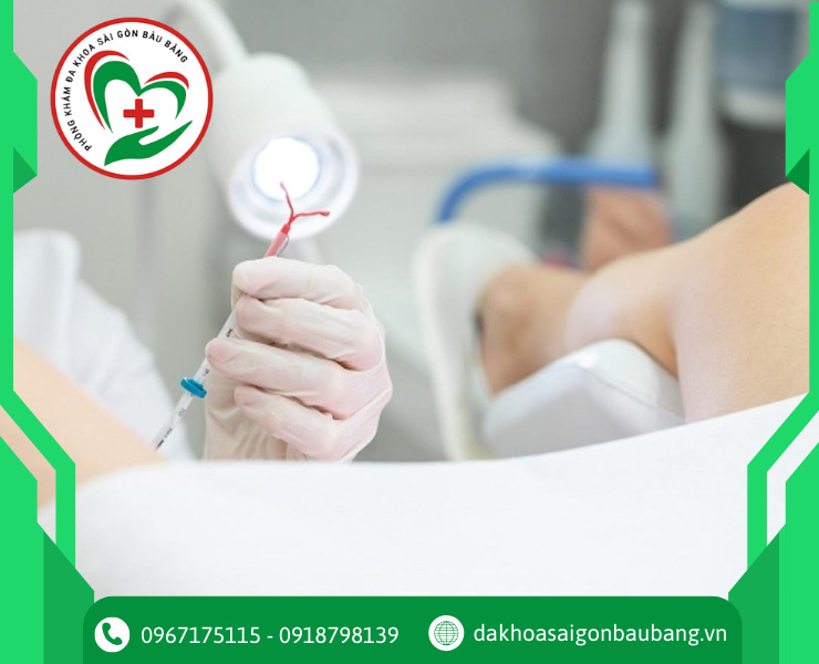 Đặt vòng tránh thai ở đâu uy tín? Gợi ý địa chỉ đáng tin cậy
