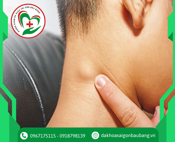 Xuất hiện khối u bất thường, phát triển nhanh