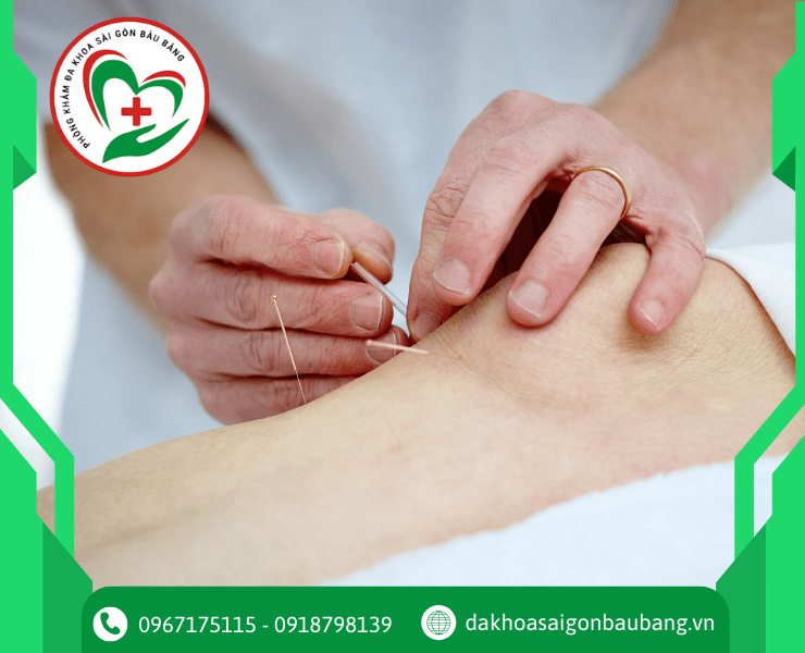 Nguyên Lý Hoạt Động Của Châm Cứu Trong Y Học Cổ Truyền