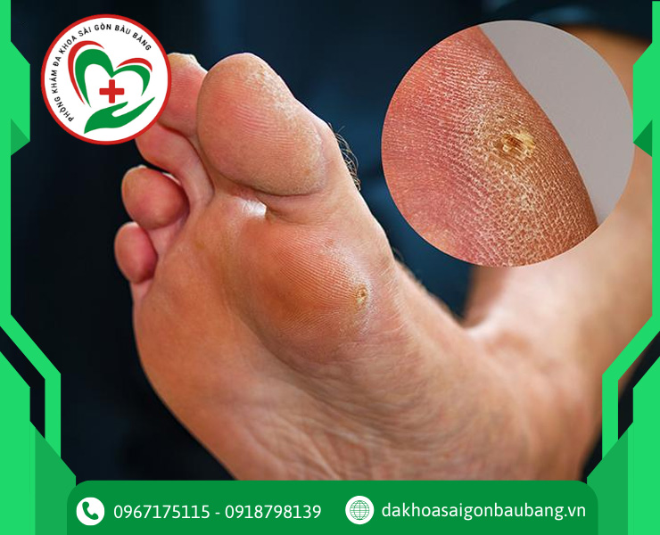 Tác hại và biến chứng nguy hiểm của bệnh đái tháo đường