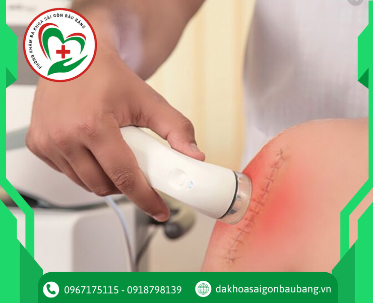 Nguyên lý hoạt động của siêu âm trị liệu