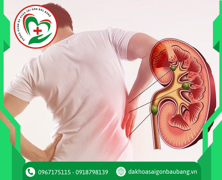 Suy thận là gì? Nguyên nhân, triệu chứng và cách phòng ngừa hiệu quả